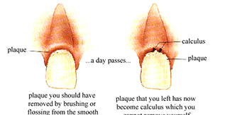 Daily Tips for Good Oral Hygiene